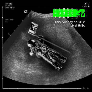 Nicki Minaj to Open the MTV Video Music Awards